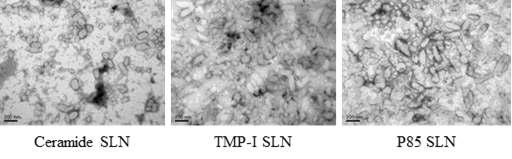고체지질나노입자 조성별 전자현미경(TEM) 사진
