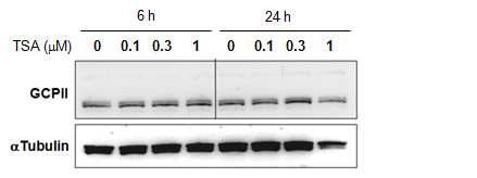 SH-SY5Y 세포 에서 TSA에 의한 GCPII 단백질 레벨 변화