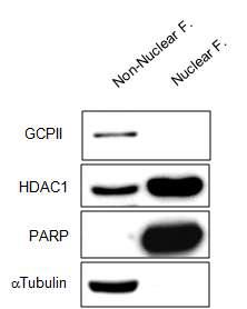 nuclear 및 non-nuclear fraction에서 GCPII 레벨 측정