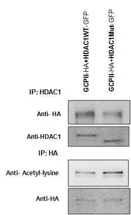 HDAC1 mutant와 GCPII와의 상호 결합