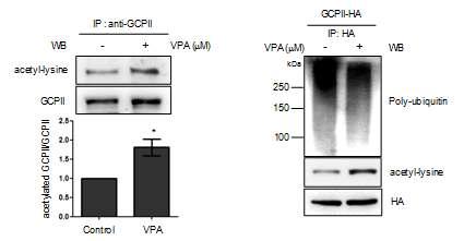 U87MG 세포에서 VPA에 의한 GCPII protein의 아세틸화 및 유비퀴틴화