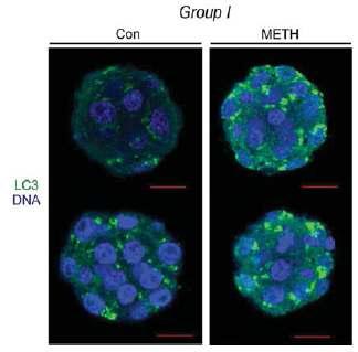 In vivo METH injection 후(그룹Ⅰ) 생쥐배아에서 LC3의 발현.