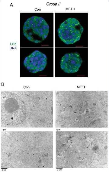 In vivo METH injection 후(그룹Ⅱ) 생쥐배아에서 LC3의 발현.