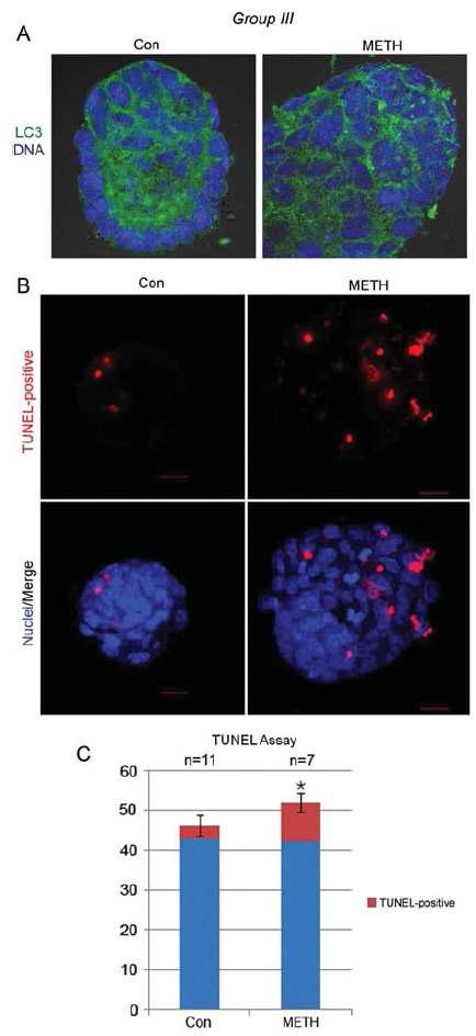 그룹 Ⅲ의 in vivo METH injection 한 마우스의 Blastocysts에서의 LC3 Immunofluorescence 와 TUNEL analysis.