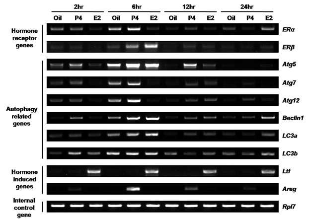 Hormone deprivation model에서 E2 또는 P4 단일호르몬에 의한 다양한 유전자 발현 조절 양상.
