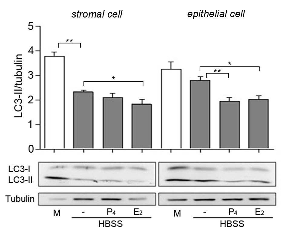 분리된 uterine epithelial cell과 stromal cell에서 LC3 발현.