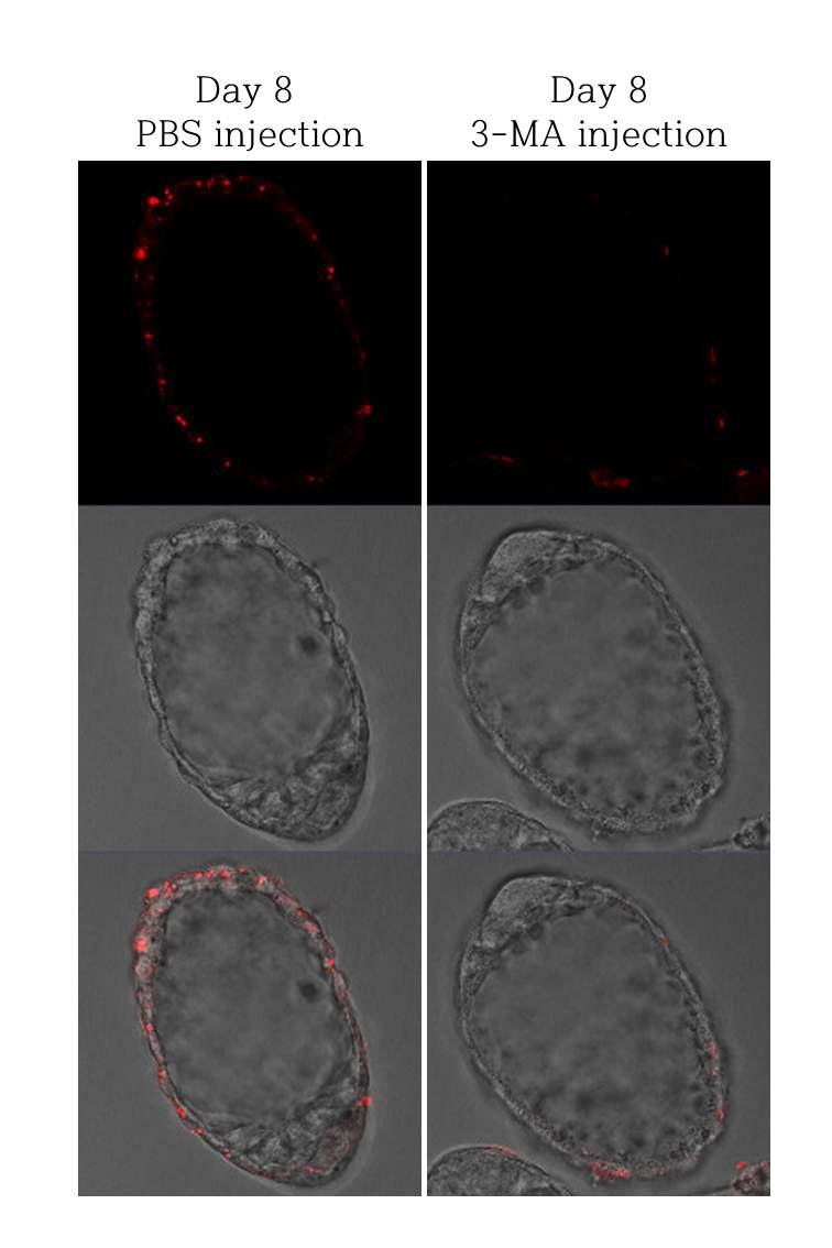 3-MA를 주사한 activated balstocyts에서의 DiI 레벨 확인