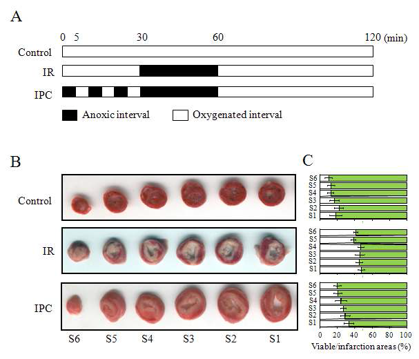 허혈/재관류(IR)와 허혈전처치(IPC)자극에서 심장 내 조직변화(infarction size) 비교