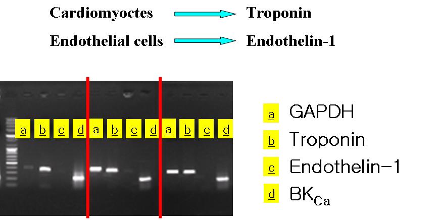 심근세포에서 BKCa 채널과 troponin, endothelin-1의 발현을 확인한 RT-PCR 사진