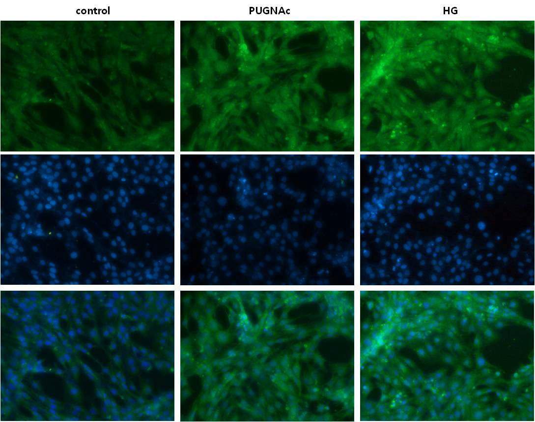 Mesangial cell에서 glycosylation에 의한 세포핵내 이동