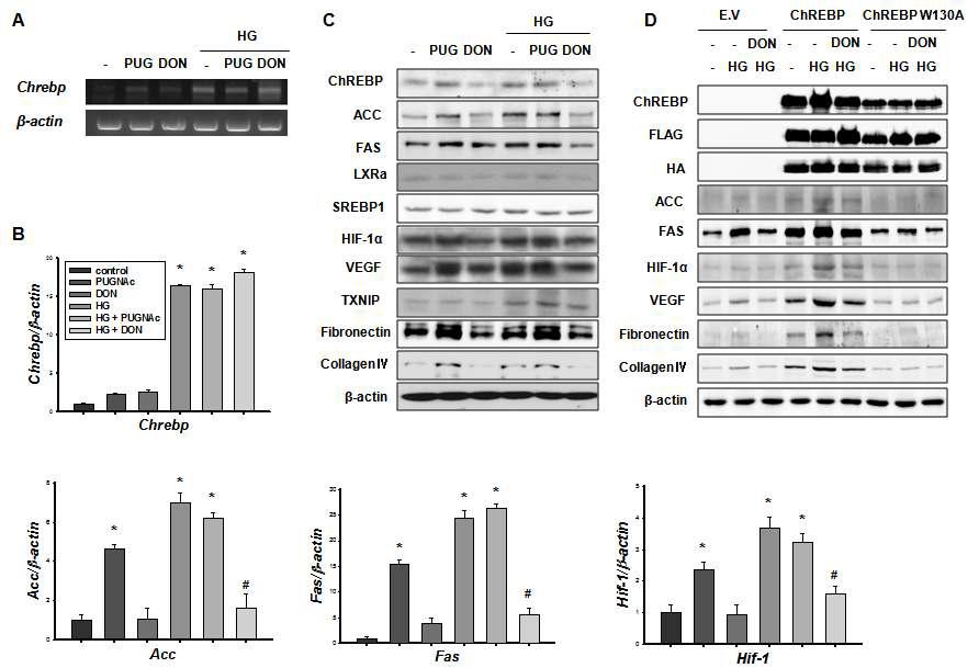 Mesangial cell에서 Chrebp의 glycosylation에 의한 지방 합성 효소 및 사구체 경화증 유도 반응 및 Chrebp W130의 효과