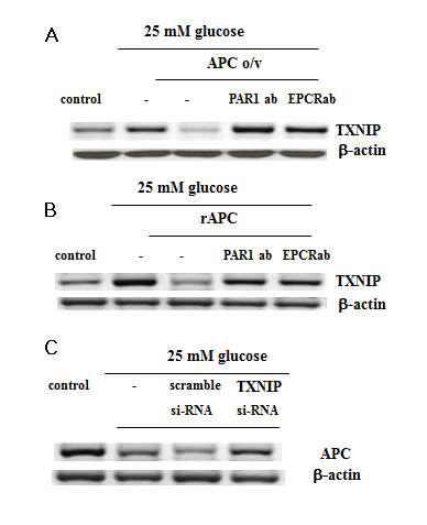 Mesangial cell에서 APC와 TXNIP의 상호 작용