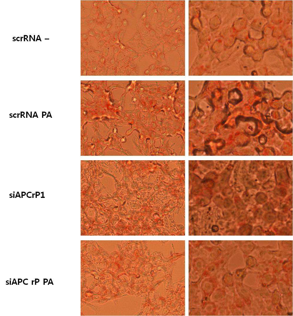 HepG2세포에서 APCrp-1의 palmitic acid에 의한 lipid accumulation 차단작용