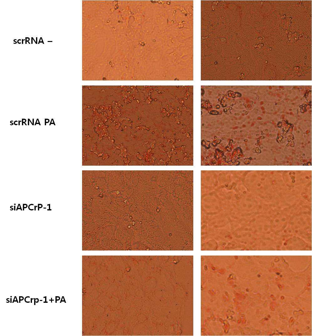 AML 12세포에서 APCrp-1의 palmitic acid에 의한 lipid accumulation 차단작용