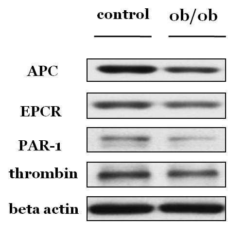 ob/ob mouse에서 APC, EPCR, PAR-1 및 thrombin의 발현 변화