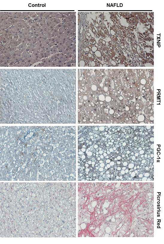 정상 및 NAFLD 사람 환자에서 immunohistochemistry