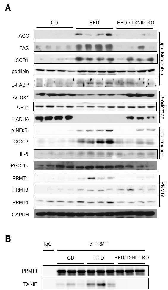 TXNIP KO mice에서 고지방 식이에 의한 지방합성, 지방산 산화 및 염증 관련 단백질 및 PRMT 발현 변화 (A) 및 PRMT1