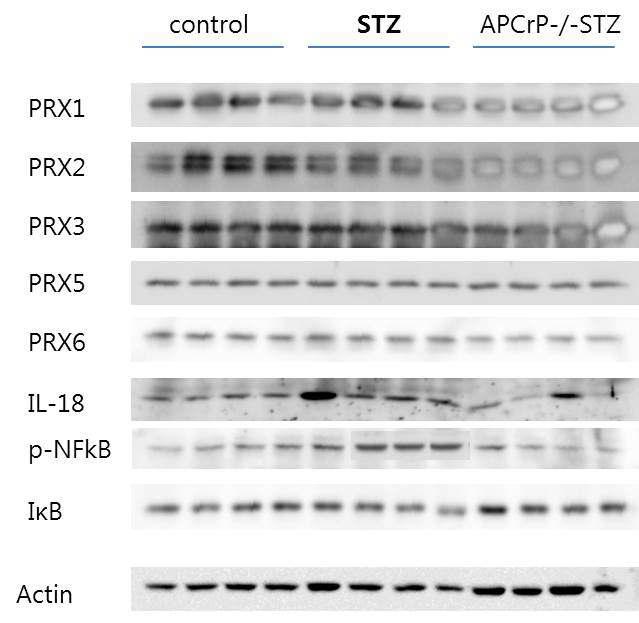 TXNIP KO mice에서 peroxiredoxin 및 IL-18, NF-kB 및 I-kB,활성에 대한 차단효과