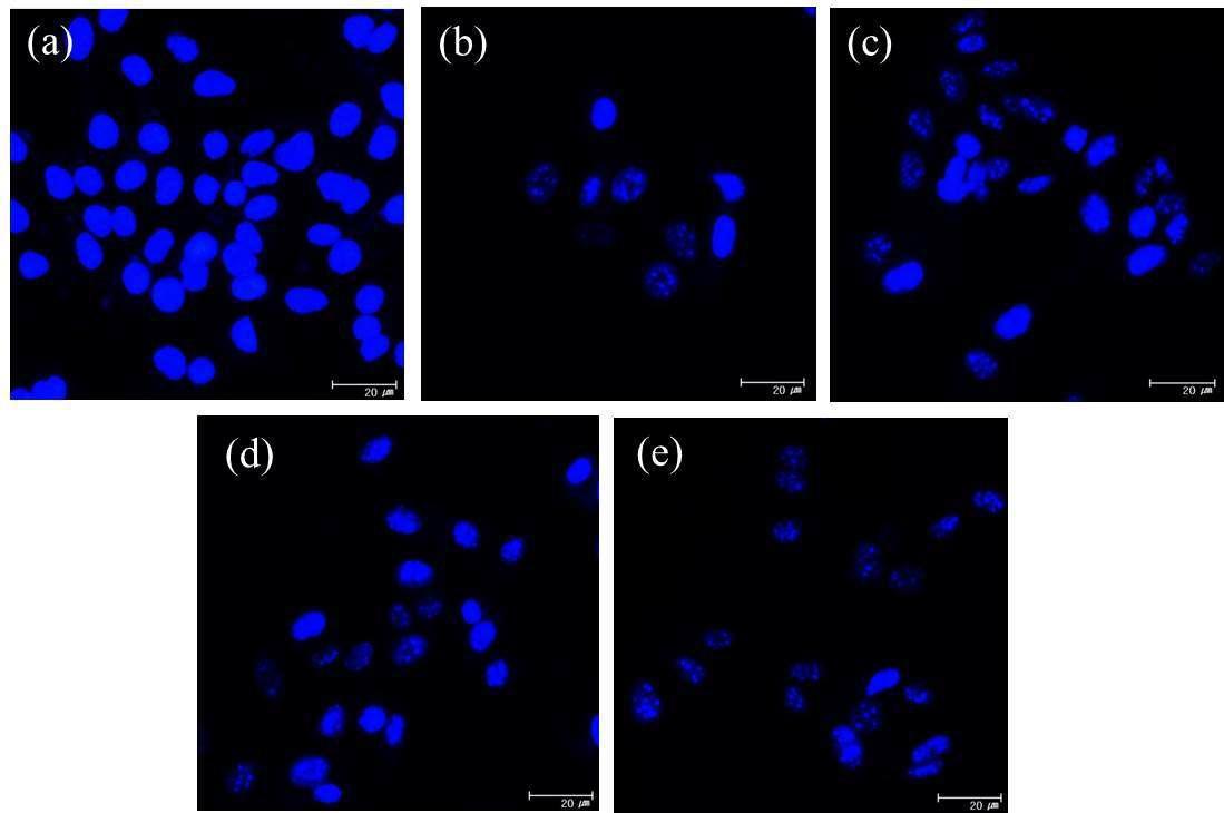 The morphological changes induced by co-treatment doxorubicin and HFCM in B16F10 cells.