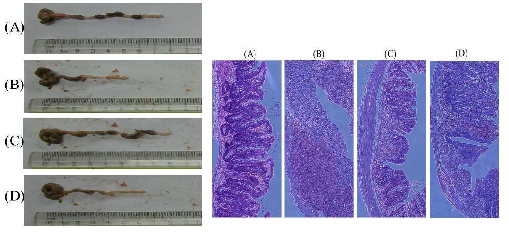 Colon length and histopathological microphotograph of colonic tissue of DSS-induced colitis mice