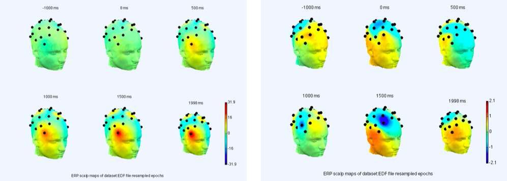 누적 복합자극 전(왼쪽)과 후(오른쪽)의 시간에 따른 뇌파변화