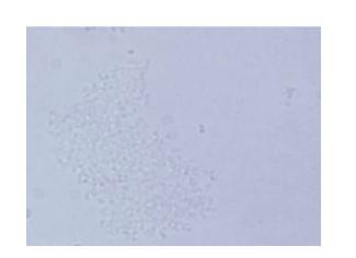 Microscopy of cell-free solution obtained after bead beating, centrifugation and filtration.