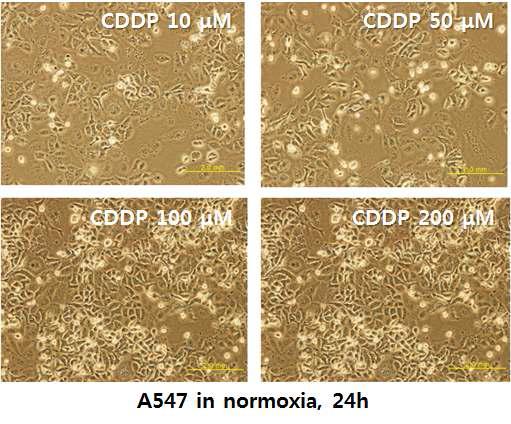 normoxia에서 A549 세포에 대한 Cisplatin(CDDP)의 효과-24시간