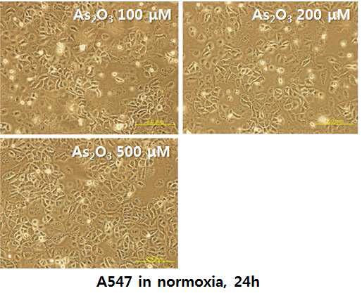 normoxia에서 A549 세포에 비소산화물의 효과-24시간