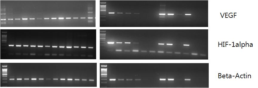 RT-PCR results of A549 cells treated with normoxa, hypoxia and EGCG