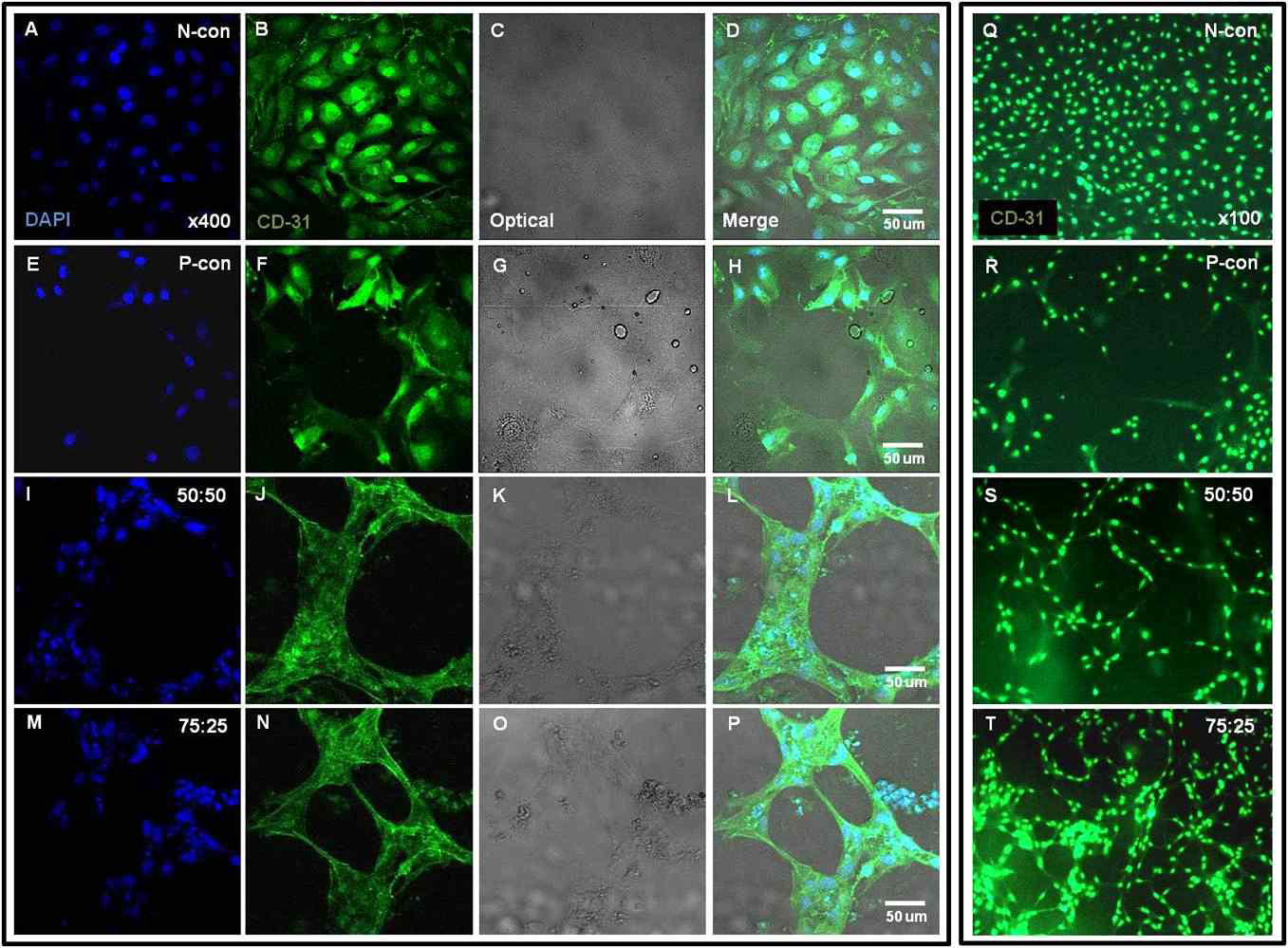 마이크로캡슐로부터 전달된 혈관생성인자(VEGF/PDGF)의 혈관내피세포 capillary-like structure 형성능 평가.