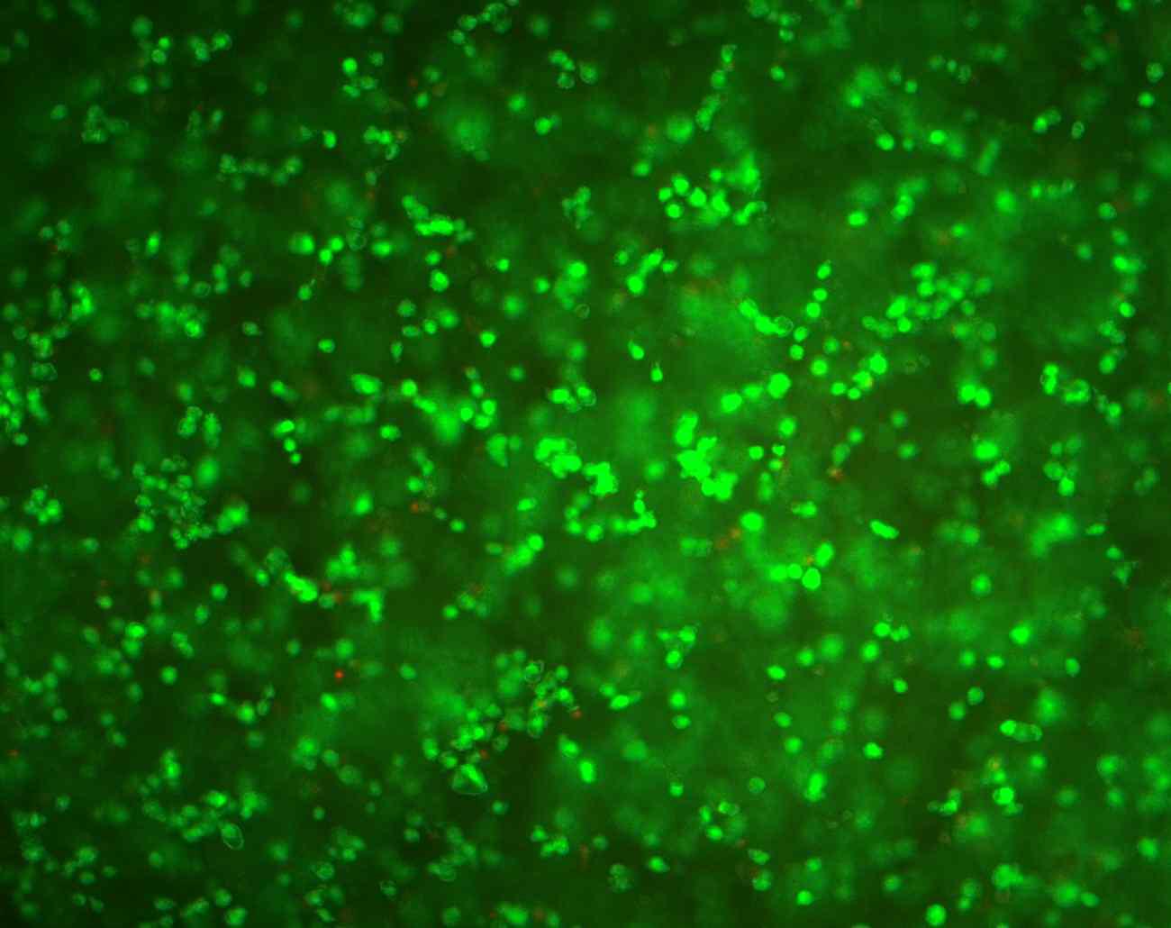 Human ASCs encapsulated in hydrogel. Samples were stained with LIVE/DEAD assay kit and images were collected using a fluorescence microscope.