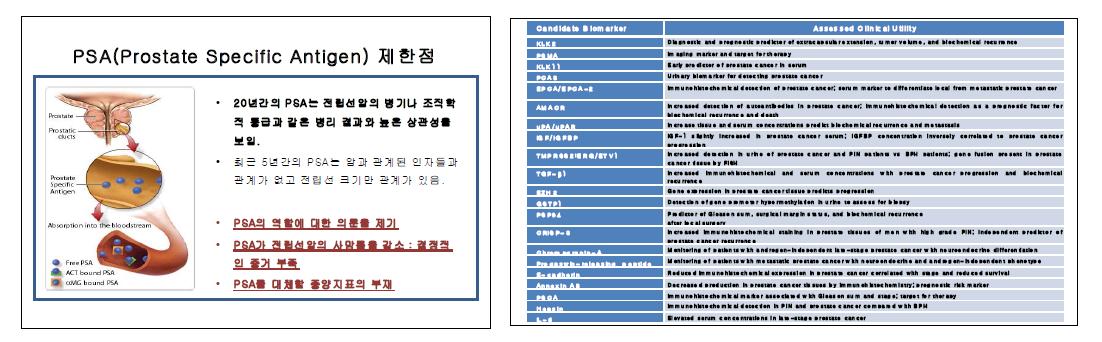 전립선암의 대표적인 바이오마커인 PSA의 제한점