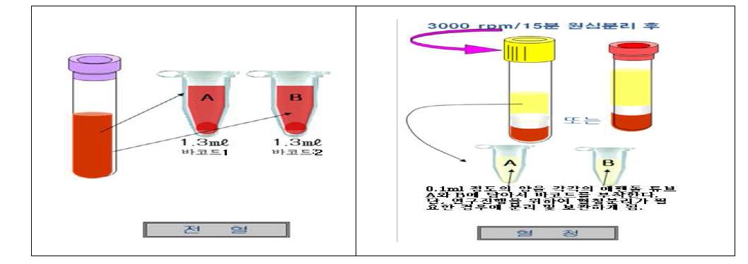 전향적 임상코호트 전립선암 검체 시료 보관