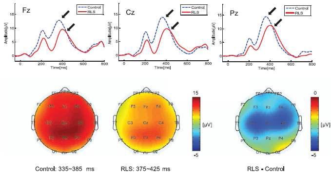 주요 세 전극에서의 ERP 파형 및 P300 시간 구간에서의 두피면상 분포도