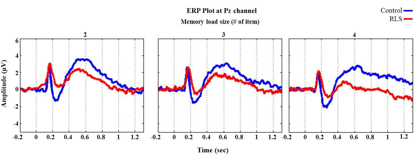 ERP waveform at Pz channel