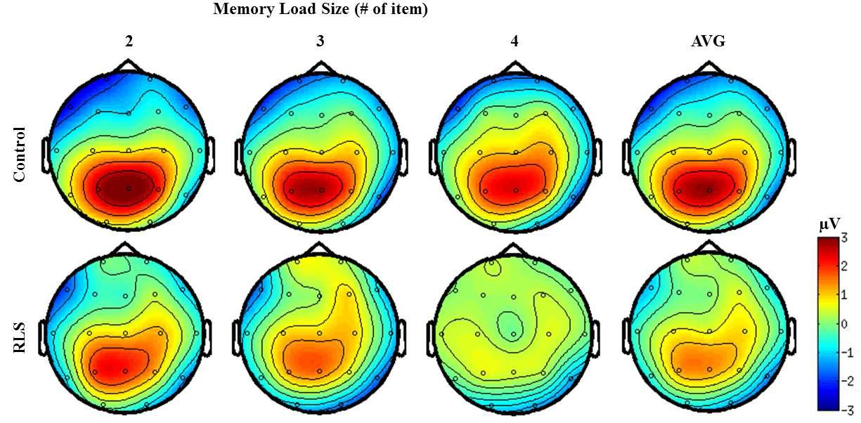 Topographical Distribution