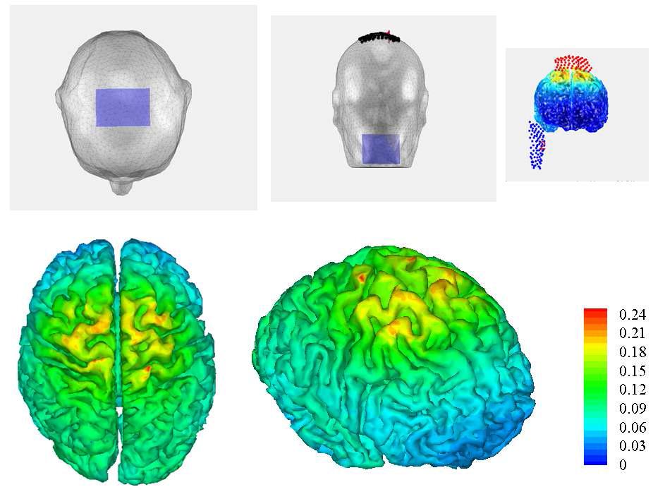 tDCS Simulation