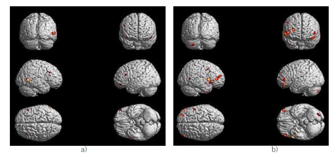 정상 대조군 1명의 fMRI 결과.