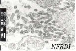 Electron micrograph of VHSV particles