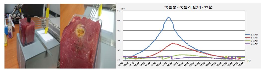 쑥뜸봉 및 온도변화 측정실험