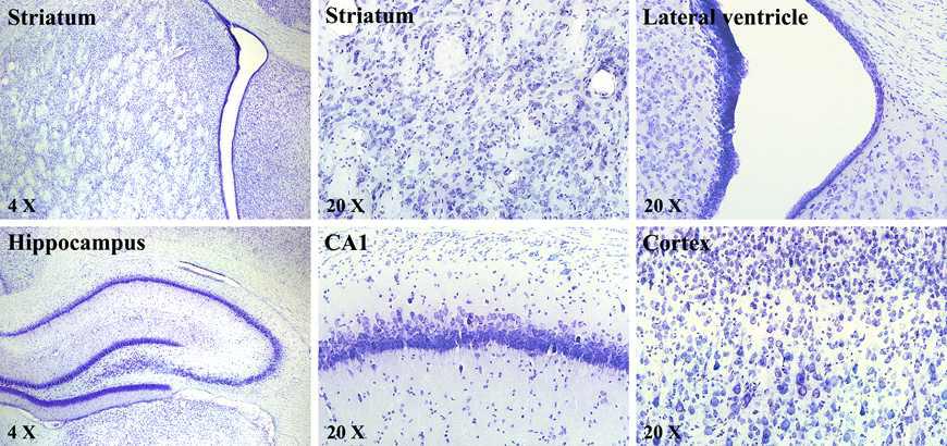 Cresyl violet staining in brain regions, Marked loss of CV-staining neurons in damaged brain region