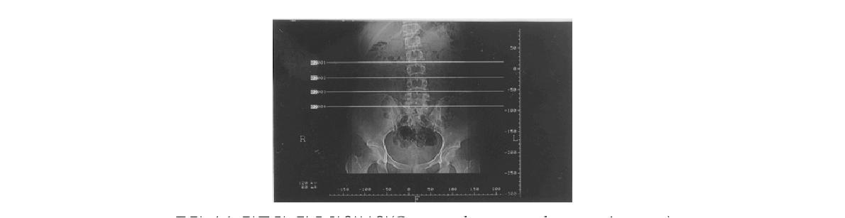 컴퓨터 단층촬영부위(Computed tomography scanning part)