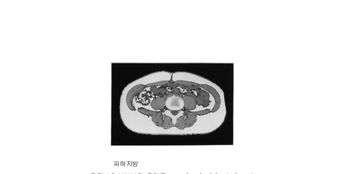 복부부위 용어(Terms of each abdominal part)