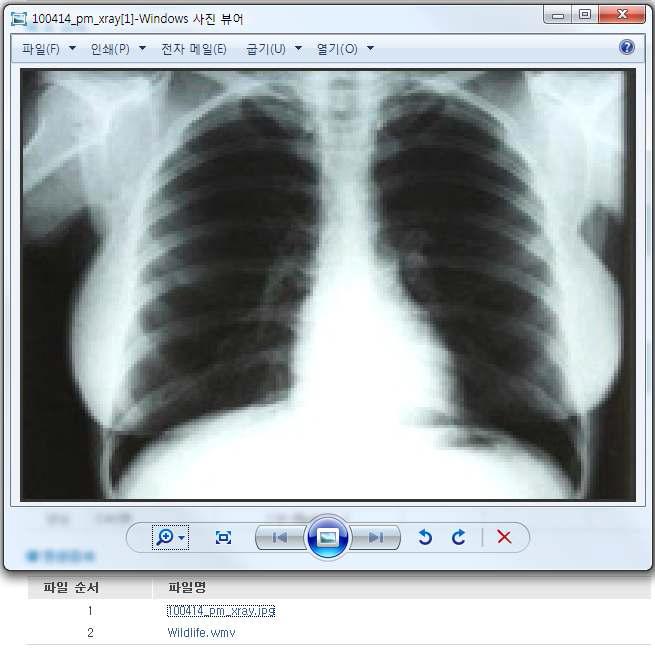 영상검사 내용 팝업으로 확인