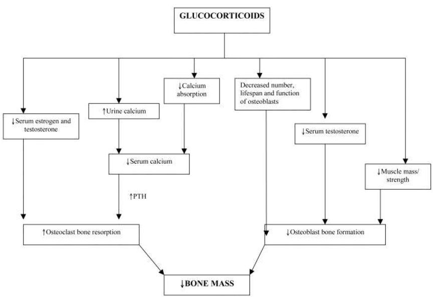 스테로이드에 의한 골밀도 감소 기전