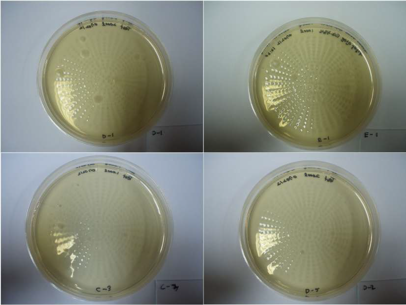 그림 1. 치과진료실내 공기 청정도를 알아보기 위해 공기 흡입기를 사용하여 1일 배양한 nutrient agar plate 상에서의 세균들이 번식한 모습