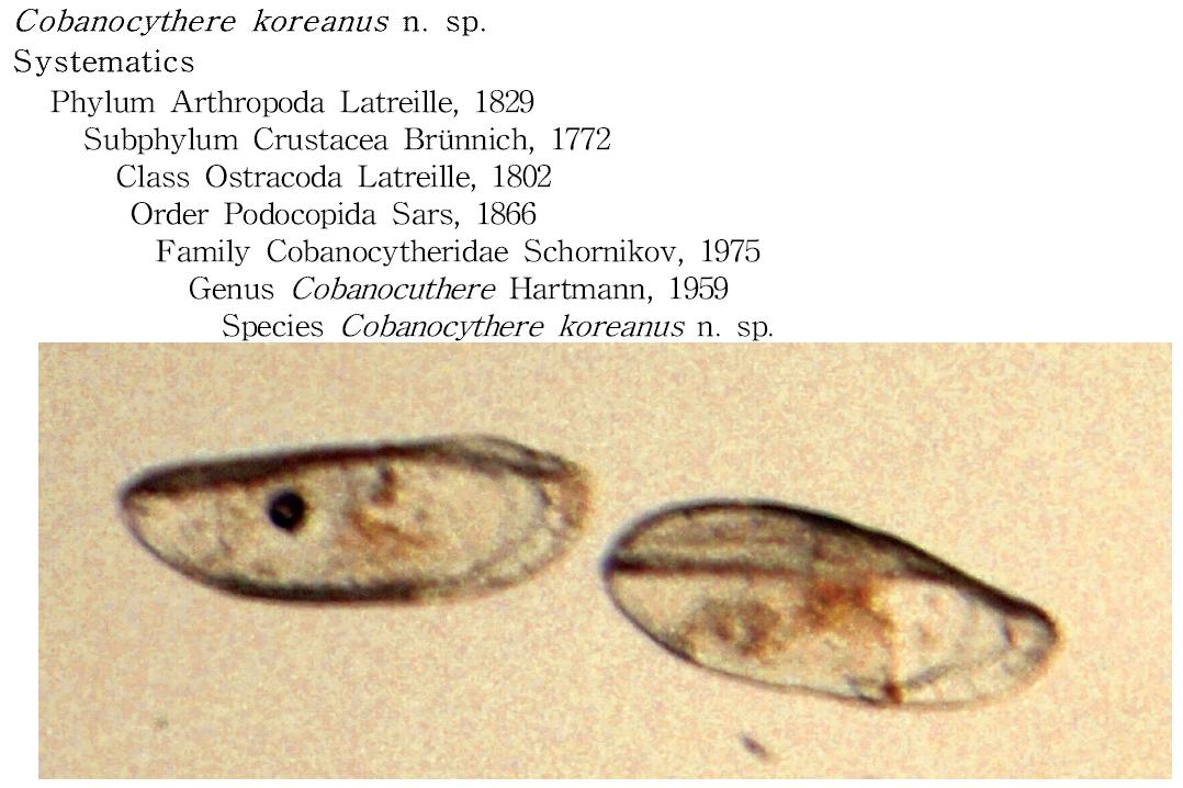 Cobanocythere koreanus n. sp.