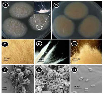 Morphological characterization of Volutella ciliata KNU14-1 observed using acompound microscope and scanning electron microscope (SEM).