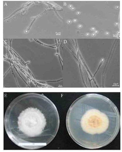 Morphology of the isolate KNU14-2 (Pseudeurotium bakeri) on potato dextrose agar (PDA).