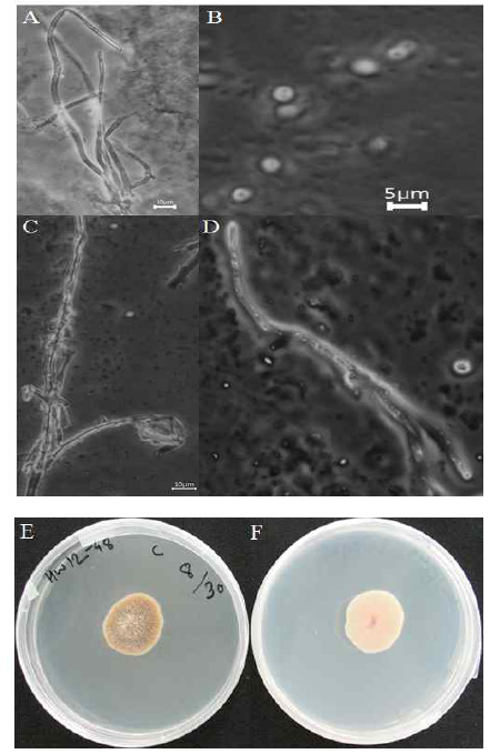 Morphology of the isolate KNU14-3 (Fusicolla acetilerea) on potato dextrose agar (PDA). (A, C, D) Mycelia, (B) Spore, (E) Front view and (F) Back view.